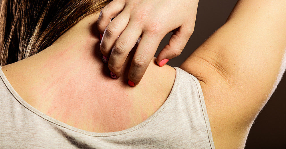 5 Reasons Why You are Allergic to Certain Clothing and What You can do to Resolve it