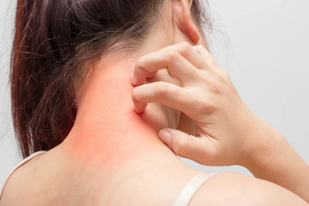 Woman scratching red irritated neck, possible allergic skin reaction to clothing fabric