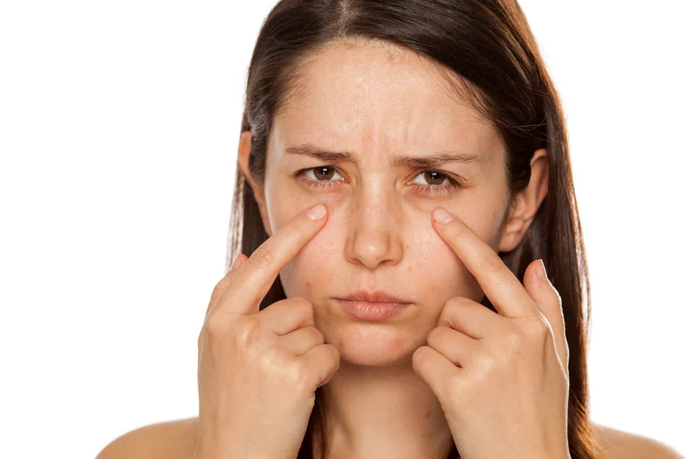 Woman with sensitive skin touching face, highlighting allergy or irritation concern