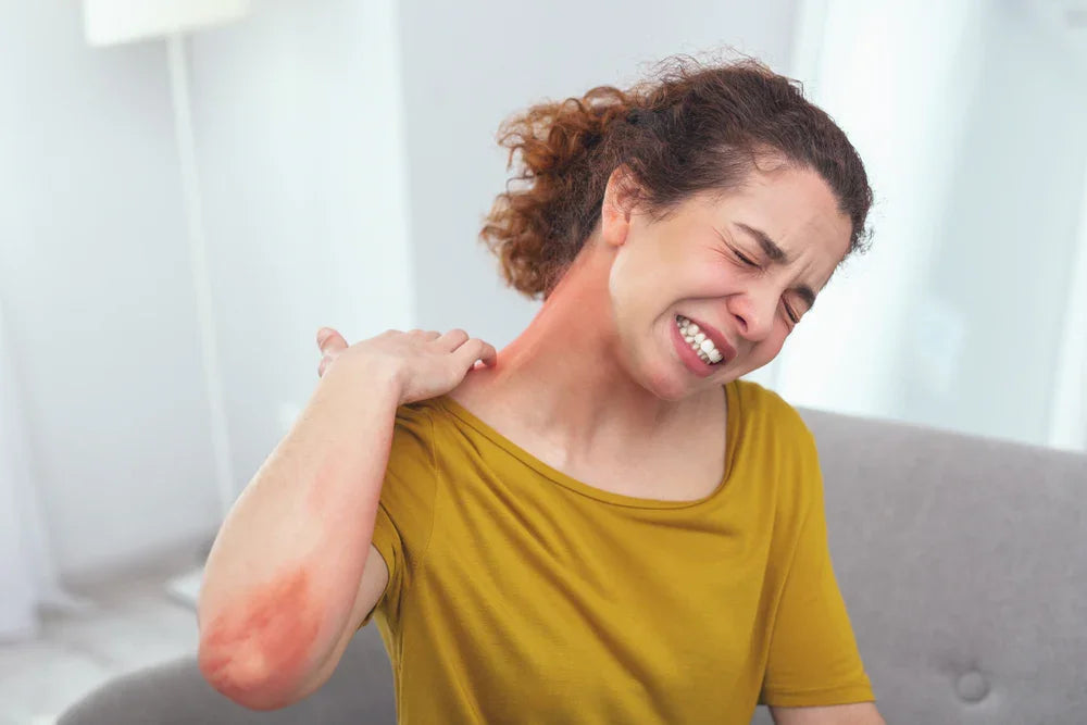 Woman with red skin irritation scratching neck and arm, allergy reaction to clothing.