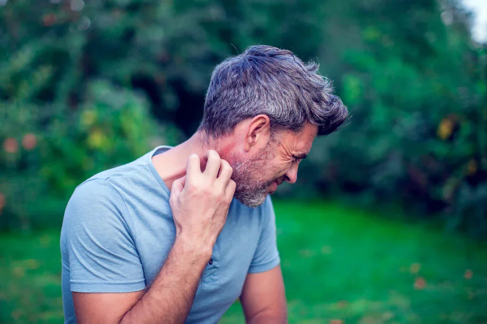Man with sensitive skin scratching neck outdoors, wearing light blue t-shirt