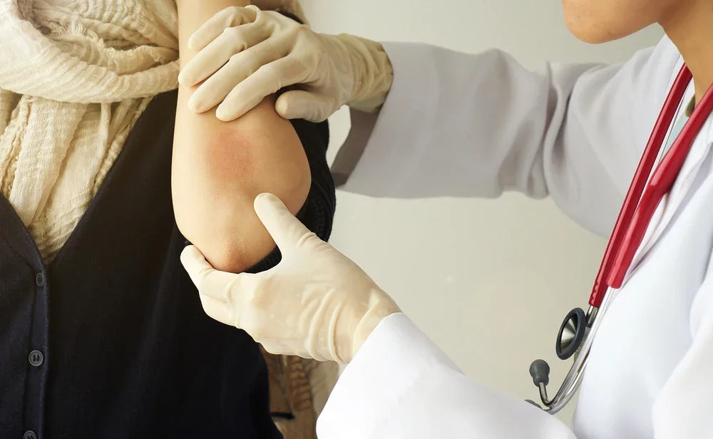 Doctor examining irritated elbow skin, eczema, allergy, dermatologist consultation