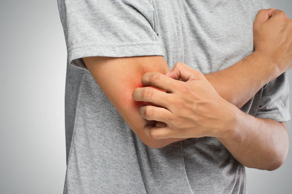 Person scratching red itchy skin on arm, highlighting clothing allergy, in gray t-shirt