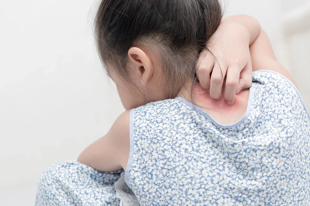 Child scratching irritated skin on back, showing symptoms of sensitive skin or eczema