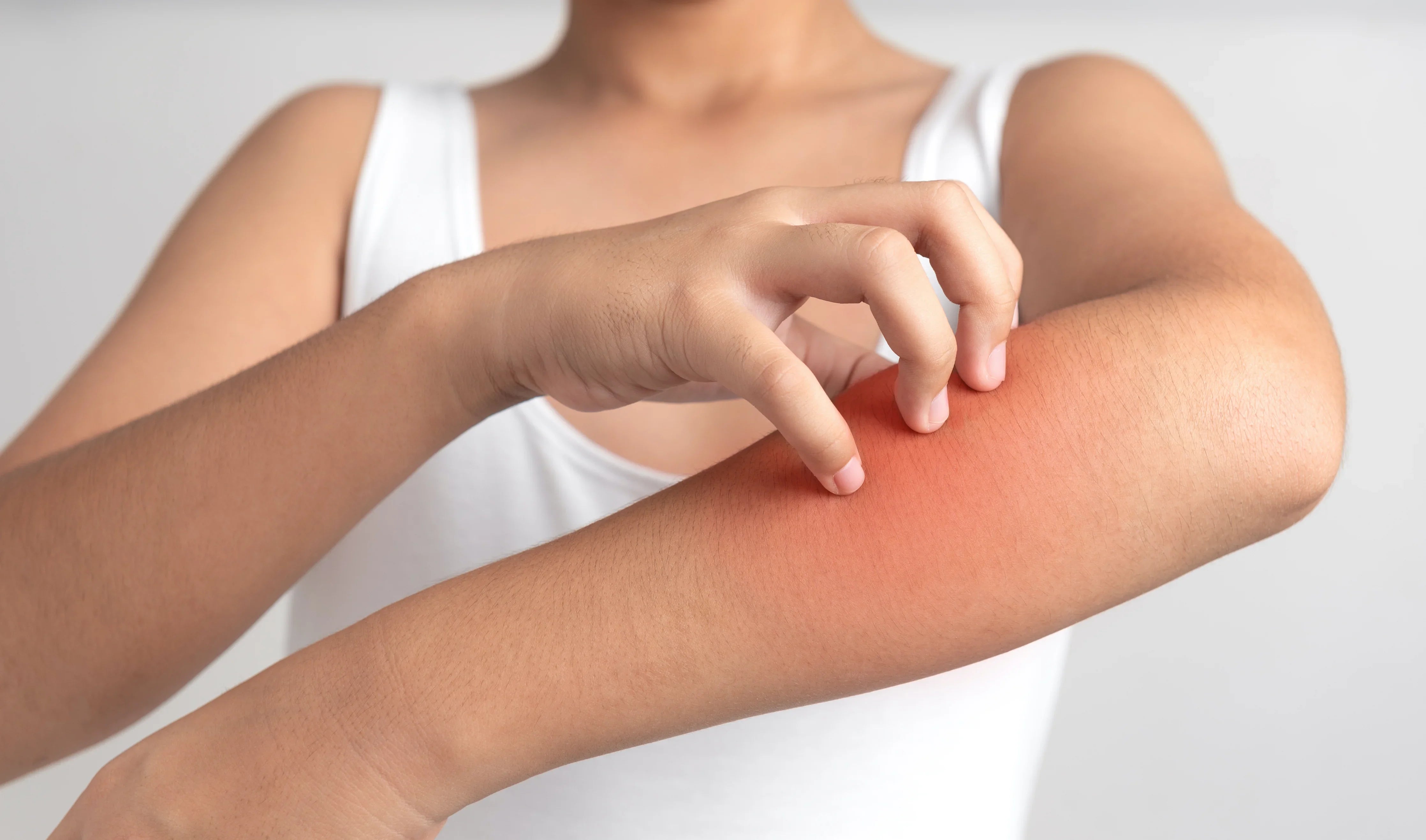 Person scratching red irritated skin on arm, allergy-free apparel concept